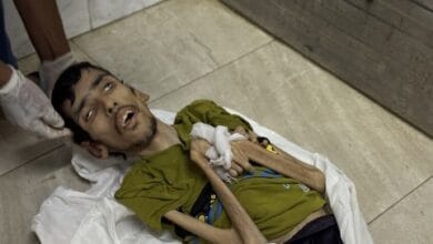 UNRWA : Des gens s'évanouissent à Gaza en raison d'une grave famine.