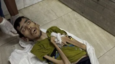 UNRWA : Des gens s'évanouissent à Gaza en raison d'une grave famine.
